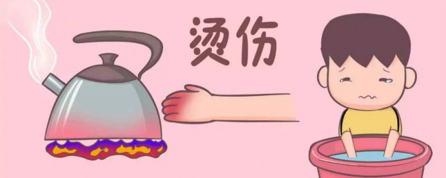 手被烫伤了如何解决(手被烫伤了要怎么办)