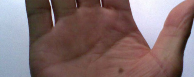 手心有痣代表的意思(手心有痣表示什么)