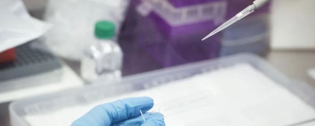 核酸检测多少钱(核酸检测多少钱?)