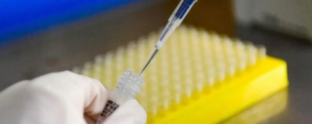 洛阳核酸检测的费用(洛阳核酸检测怎么收费)