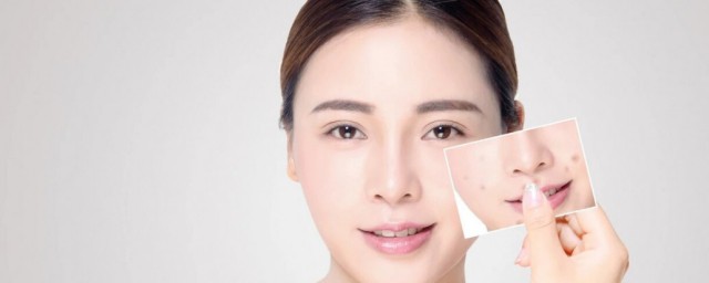 什么是刷酸(什么是刷酸面膜)