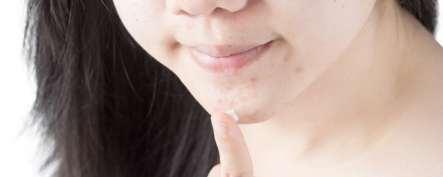 简单的痘印祛除小窍门是什么(祛痘痘印的小窍门)