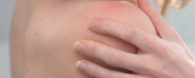 皮肤干燥瘙痒该怎么办(皮肤干燥痒有什么办法)