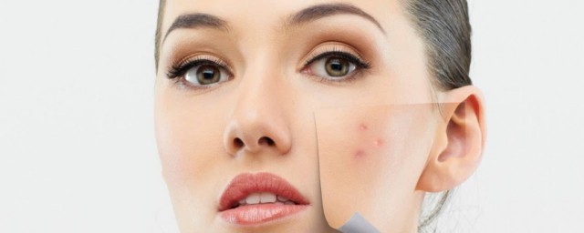 遮痘印方法(如何遮盖痘印)