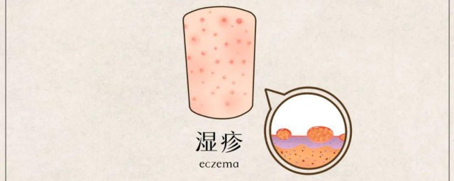 湿疹饮食禁忌是什么(湿疹应注意什么饮食禁忌)