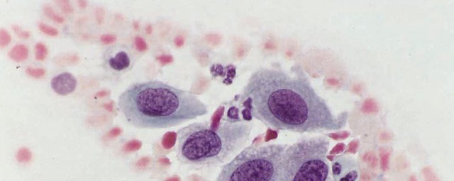 上皮细胞意思介绍(上皮样细胞是什么意思)