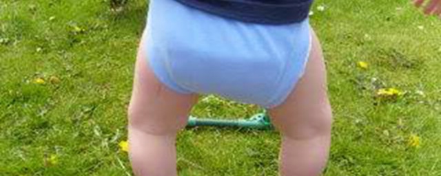 o型腿矫正方法(O型腿矫正方法站姿视频)