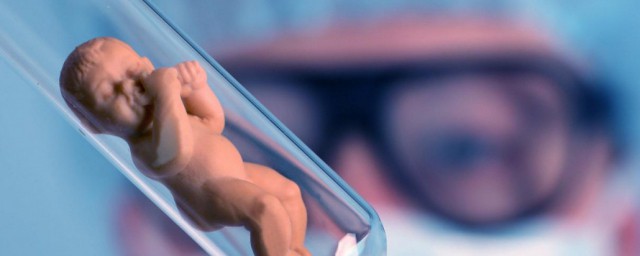 做试管婴儿方法(试管婴儿方式)