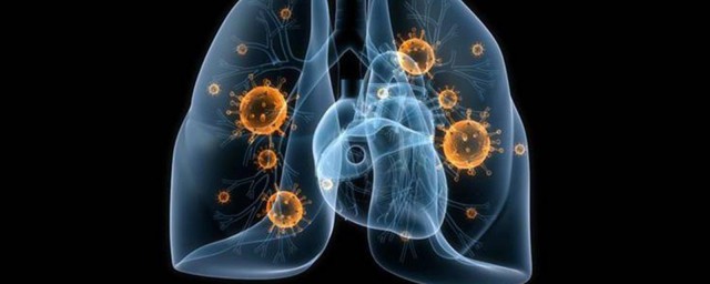 肺炎饮食禁忌介绍(肺炎注意哪些饮食禁忌)