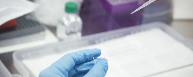 核酸检测多少钱(核酸检测多少钱一次混检)