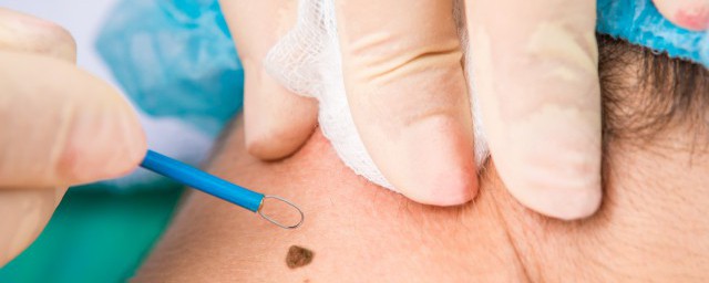 食禄痣的意思是什么(食禄痣是什么预兆)