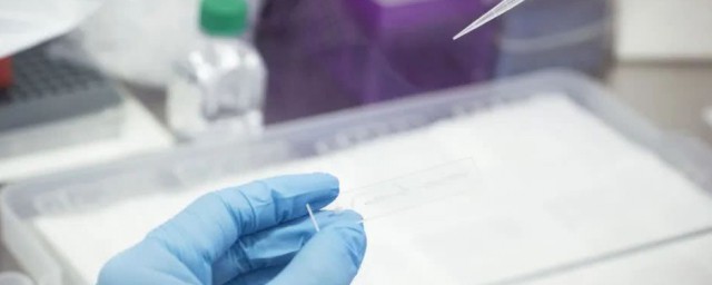 做核酸检测多少钱(做核酸检测多少钱是自费吗)