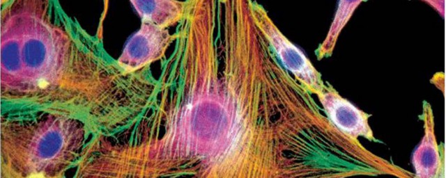 细胞骨架介绍(细胞的细胞骨架)