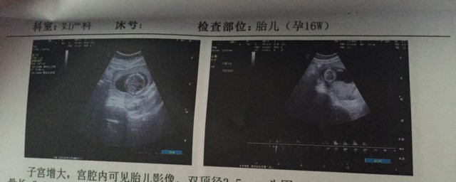 怀孕几个月可以看出来性别(怀孕几个月可以看出来胎儿性别)
