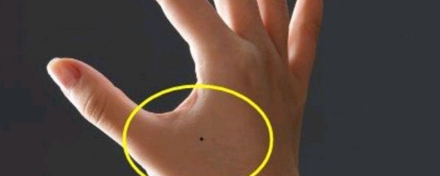 左手背上有痣代表(左手背上有痣代表什么女)