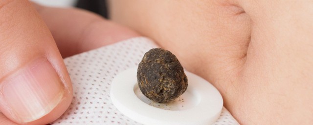 艾脐贴要晚上用的原因(艾脐贴晚上什么时候贴)