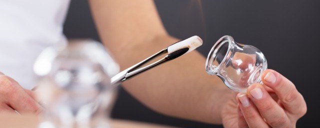拔罐注意事项和禁忌症有哪些(拔罐的禁忌症和注意事项)