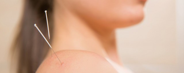 针灸的注意事项和禁忌症有哪些(针灸的宜忌)