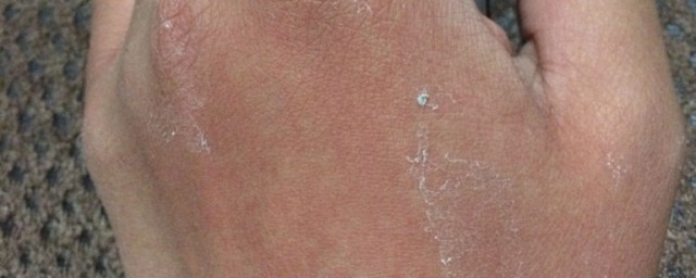 手上胶水洗掉方法(如何洗去手上的胶水)