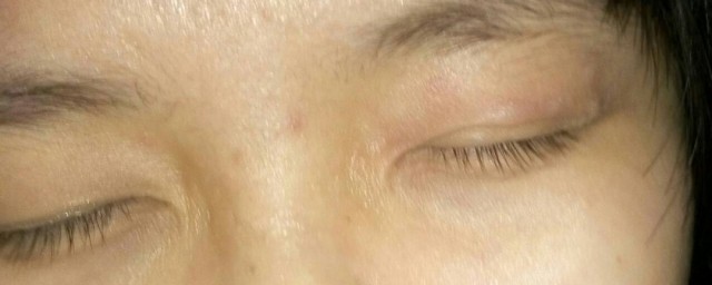 内眼角痒处理窍门(内眼角痒如何缓解)