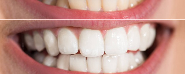 牙床不能睡觉脑筋急转弯对吗(什么床不能睡觉脑筋急转弯答案)