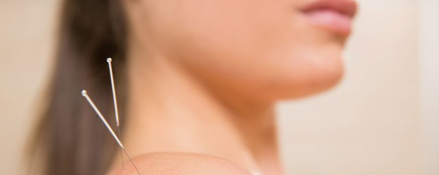 针灸禁忌症及注意事项是什么(针灸禁忌内容)