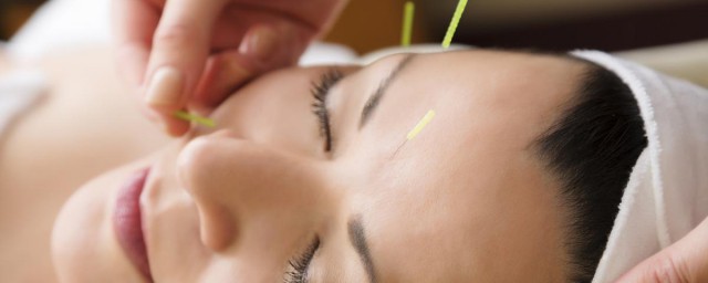 针灸注意事项和禁忌症分享(针灸治疗禁忌)