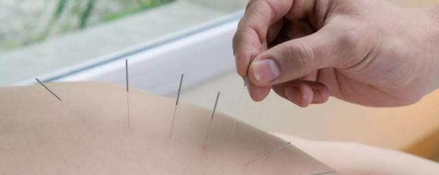 针灸的禁忌和注意事项分享(针灸的十大禁忌)