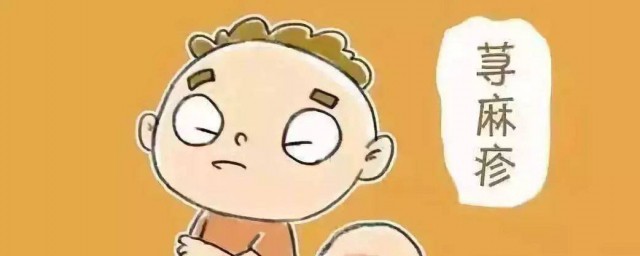 荨麻疹要注意什么(人工荨麻疹要注意什么)