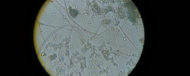 蛋白质的盐析简单介绍(蛋白质盐析举例)