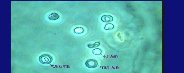 镜检红细胞介绍(镜检红细胞是啥意思)