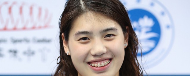 张雨个人资料是什么(你知道章鱼吗)