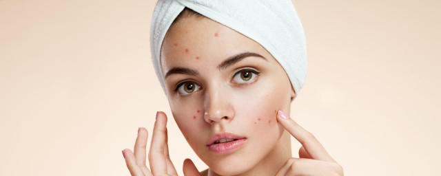 水痘不可以吃什么(得了水痘不可以吃什么)