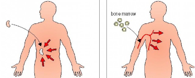 gvhr医学上的意思(grv医学上是什么意思)