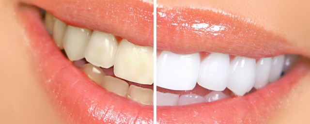 人的牙齿每颗的名称各称为什么(每一颗牙齿叫什么名字)