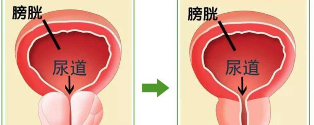 前列腺的作用(前列腺的作用是干什么的)