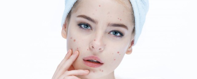 祛痘痘怎样最有效(怎么祛痘最有效的方法)