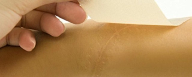 怎样去烫伤疤痕(怎么去烫伤疤)