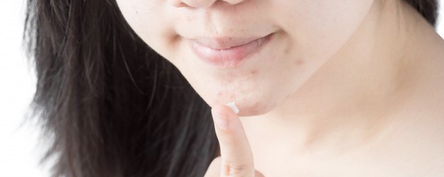 怎么去除痘印呢(怎么样去除痘印)