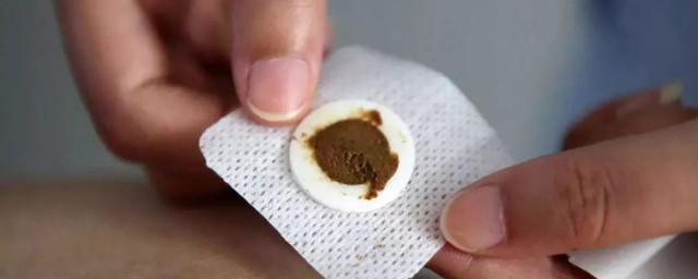 三伏贴的介绍(三伏贴的相关知识)