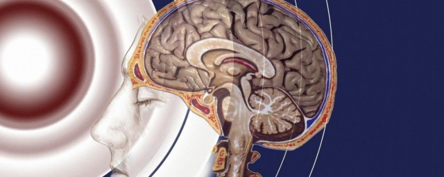 脑疝如何解释(脑疝是怎么形成)