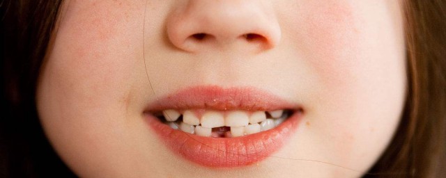 关于做梦梦见牙齿掉了的意思(做梦梦见牙齿掉了什么意思)