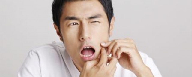 美白祛斑需要注意什么(美白祛斑用在哪一步)