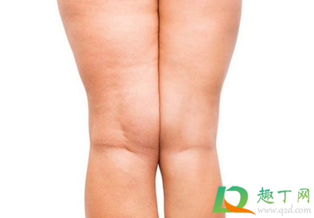 橘皮组织怎么消除(橘皮组织怎么消除知乎)