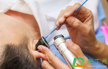 小孩用不用采耳(儿童要不要采尔) 小孩用不用采耳(儿童要不要采尔)