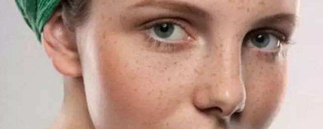 如何祛斑(如何祛斑小妙招)