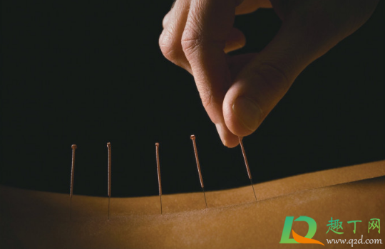 打新冠疫苗可以拔罐吗(打新冠疫苗能去拔罐吗)