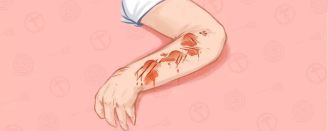 脸上有疤怎么办(初中生脸上有疤怎么办)