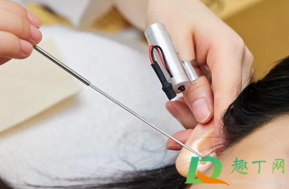 油耳朵怎么掏耳屎(油耳屎用什么掏) 油耳朵怎么掏耳屎(油耳屎用什么掏)