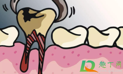 刚拔完智齿能吃什么东西(刚拔完智齿可以吃什么)